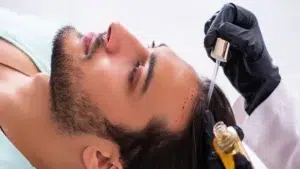 Understanding the Factors That Determine Hair Transplant Costs