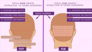 donor condition