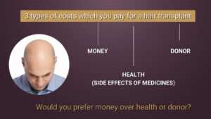 cost of hair transplant