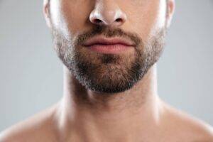 Beard hair transplant in delhi