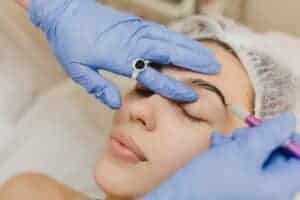 eyebrow hair transplant in delhi