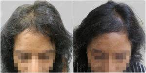 female hair results before and after