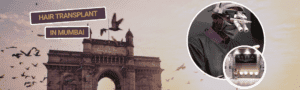 hair transplant in mumbai