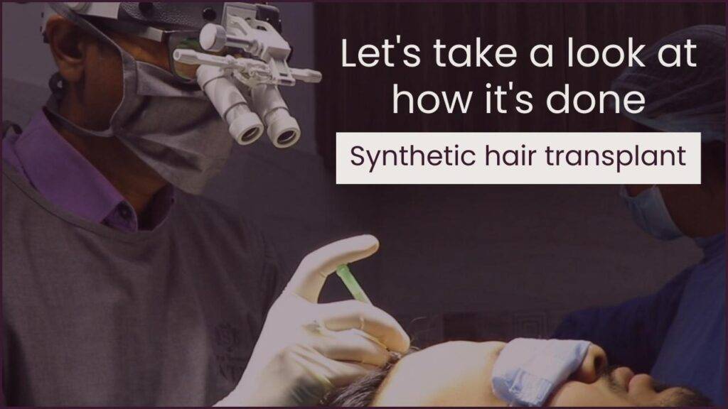 synthetic hair implant