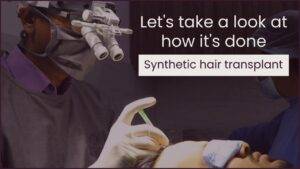 Synthetic/Artificial Hair Implant at Satya Hair Solutions