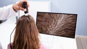 Female Hair Treatment