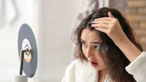 Female Pattern Baldness