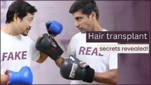 Hair transplant results comparison