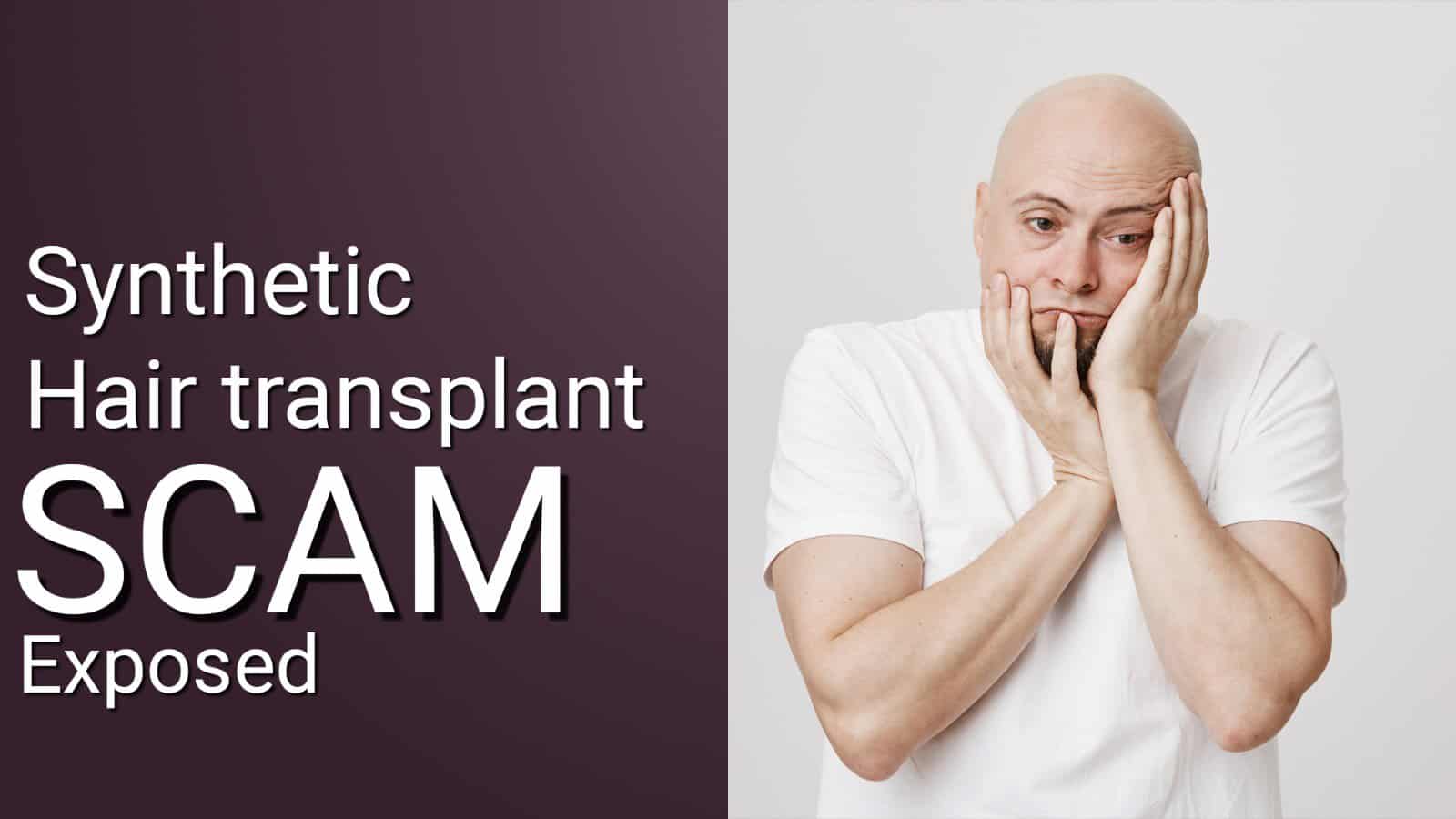 hair transplant