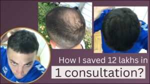 hair restoration