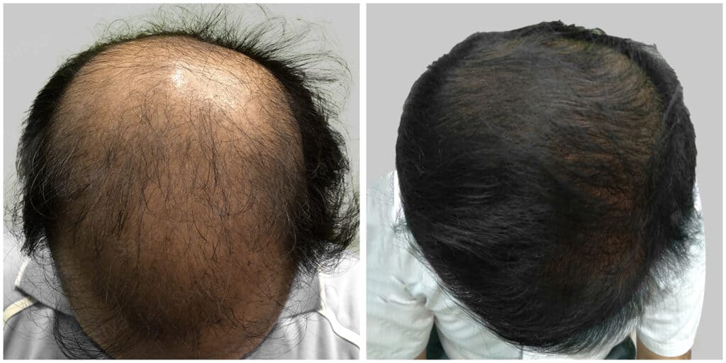 medicine treatment results