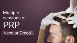 prp treatment
