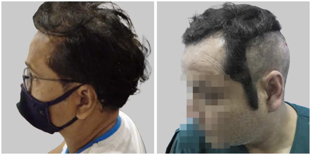 medicine treatment results