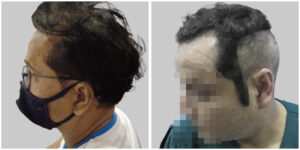 medicine treatment results