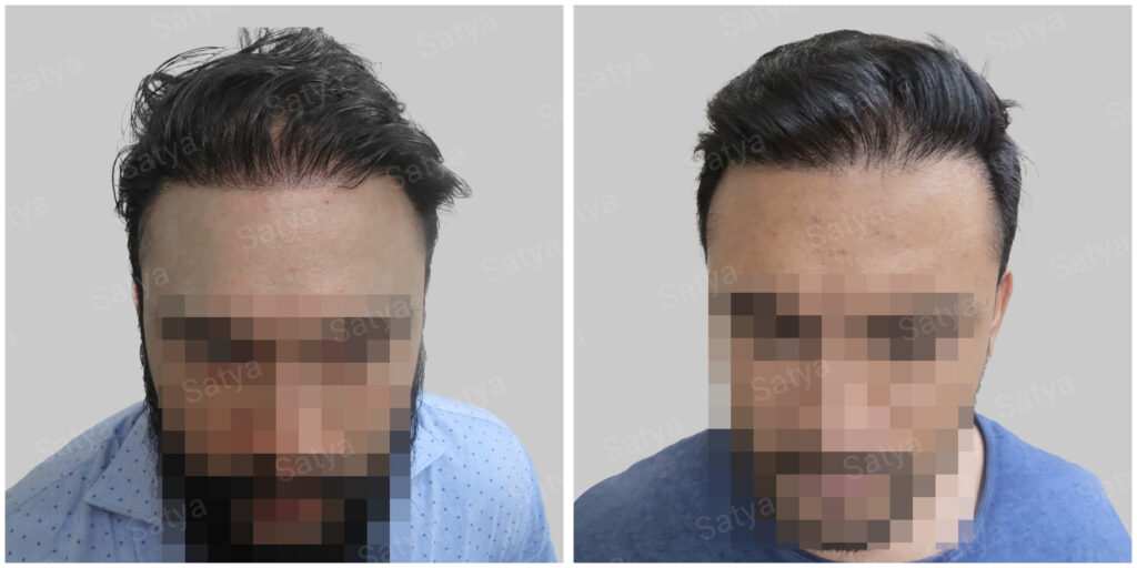 wrong hair repair result