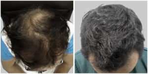 medicine treatment results