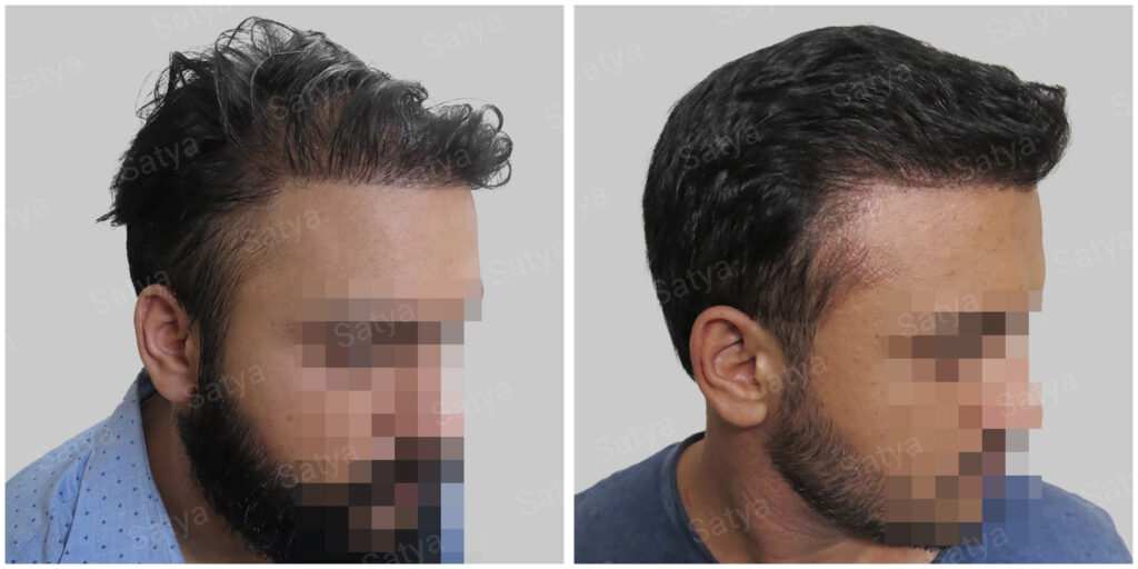 wrong hair repair result