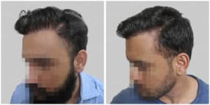 corrective hair repair result