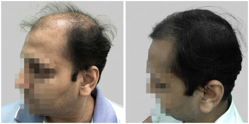 medicine treatment results