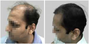 medicine treatment results