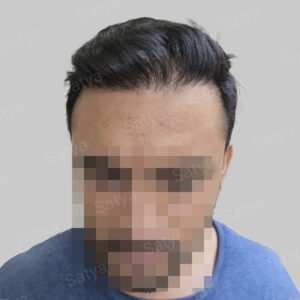 corrective hair repair result