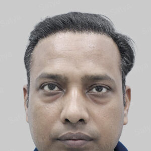 repair hair transplant