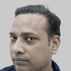 repair hair transplant