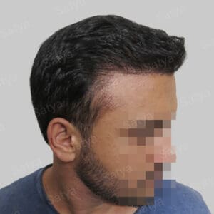 corrective hair repair result