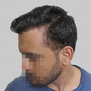 wrong hair repair result