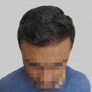 corrective hair repair result