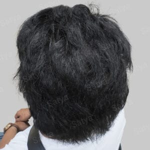 wrong hair line repair