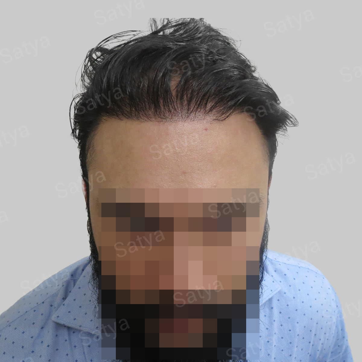 wrong hair repair result