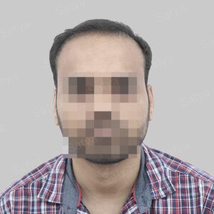 repair hair transplant