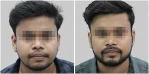 beard restoration