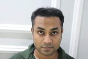 synthetic hair implant