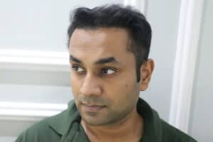 synthetic hair implant