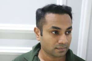 synthetic hair implant