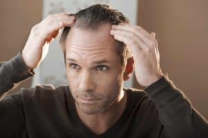 male pattern baldness