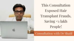 hair transplant in india