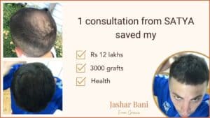 repair hair transplant
