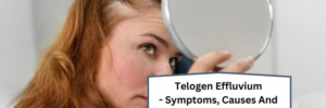 Telogen Effluvium