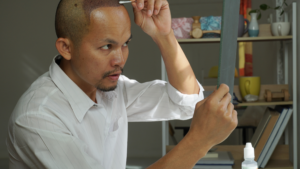 High Density Hair Transplant