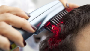 LASER HAIR RESTORATION
