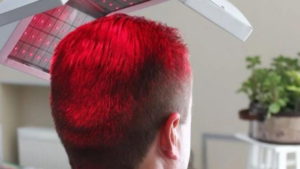 LASER HAIR RESTORATION