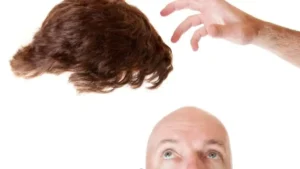 hair wig at satya hair solution