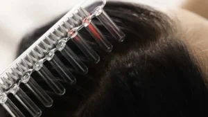 laser comb treatment at satya hair solution