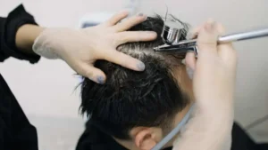 mesotherapy treatment in delhi at satya hair solution