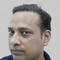 repair hair transplant