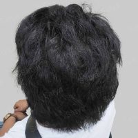 wrong hair line repair