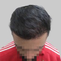 wrong hair repair result